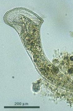 Stentor roeseli.jpg