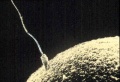 Fertilization (Sperm/Ovum)