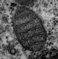 Mitochondria.