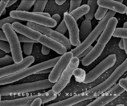 800px-Escherichia coli.jpg