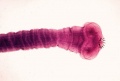 Thumbnail for version as of 03:40, 2 March 2006