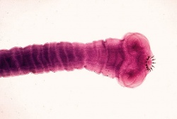 Tenia solium scolex.jpg