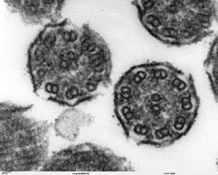 File:Lung cilia.jpg