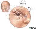 Thumbnail for version as of 02:21, 11 May 2010