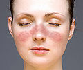 Thumbnail for version as of 01:34, 23 October 2009