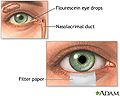 Thumbnail for version as of 00:36, 6 May 2010