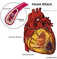 Thumbnail for version as of 03:56, 26 October 2009