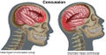 Thumbnail for version as of 06:30, 13 January 2015