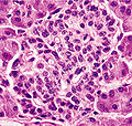 Thumbnail for version as of 07:49, 4 January 2010