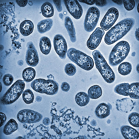 File:Salmonella2.jpg