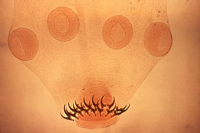 File:Tapeworm scolex.jpg