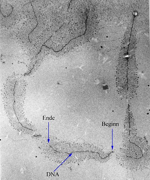 Ficheiro:Transcription electronmicrograph.jpg