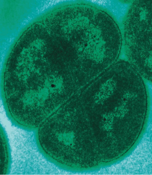 File:521px-Deinococcus radiodurans.jpg
