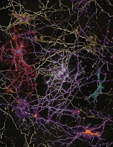 File:Neuron.jpg