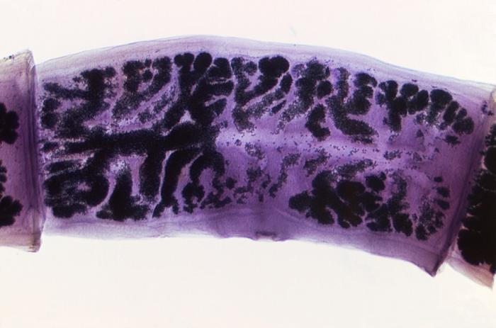 File:Single proglottid.jpg