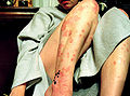 Thumbnail for version as of 05:36, 1 December 2010