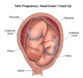 Thumbnail for version as of 12:28, 13 May 2019
