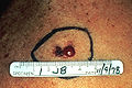 Thumbnail for version as of 05:17, 4 January 2010
