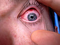 Thumbnail for version as of 08:13, 26 March 2009