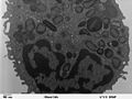 Transmission electron microscope image of a thin section cut through a human leukocyte (white blood cell) of the type Eosinophil. Eosinophils contain eosinophil granules that are large (0.1-1.0micron) spherical, membrane-bound structures, containing a dense and lamellated crystalloid core.
