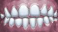Thumbnail for version as of 09:17, 6 December 2017