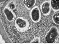 Cross section though a soybean root nodule.