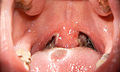Thumbnail for version as of 09:44, 8 March 2010