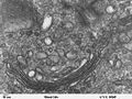 Golgi apparatus in a human leukocyte.