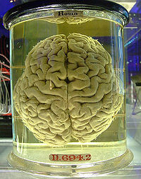 Humanbrain.jpg