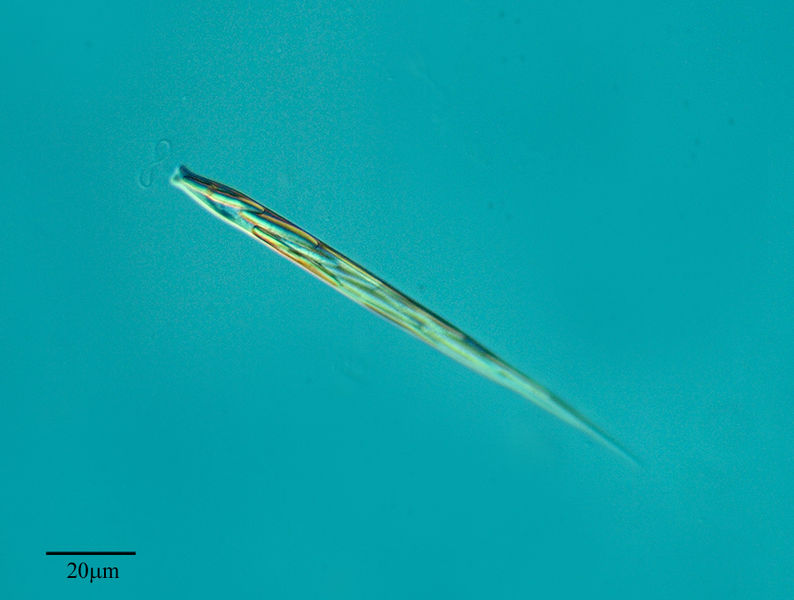 File:Euglena acutissima.jpg