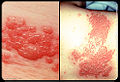 Thumbnail for version as of 04:42, 9 December 2010