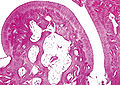 Thumbnail for version as of 11:23, 18 February 2011