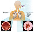 Thumbnail for version as of 23:49, 9 December 2010