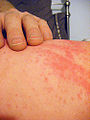 Thumbnail for version as of 00:56, 2 March 2010