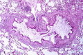 Thumbnail for version as of 04:25, 3 December 2010