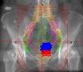Thumbnail for version as of 03:59, 7 November 2013