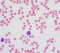 Thumbnail for version as of 01:24, 26 December 2009
