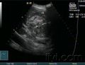 Thumbnail for version as of 06:14, 18 October 2016