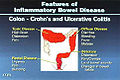 Thumbnail for version as of 03:23, 2 November 2012