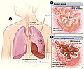 Thumbnail for version as of 15:52, 12 May 2010