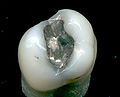 Thumbnail for version as of 05:23, 22 May 2009