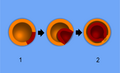 Thumbnail for version as of 00:04, 25 June 2009