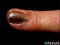 Thumbnail for version as of 04:57, 4 January 2010