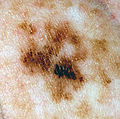 Thumbnail for version as of 00:40, 4 January 2010