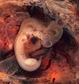 Human embryo at 5 weeks from ectopic pregnancy.