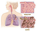 Thumbnail for version as of 20:54, 24 October 2009