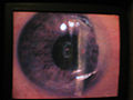 Thumbnail for version as of 08:38, 12 May 2010