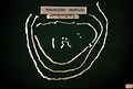 tapeworm (Taenia saginata ) Subtaxa:Cyclophyllidea