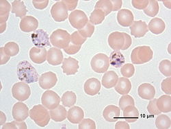 Plasmodium.jpg