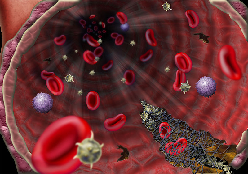 File:Blood clotting.jpg